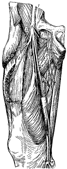 . 142.   () -   . 1 -  ; 2 -        ; 3 -     ; 4 -   (nervus saphenus); 5 -  ; 6 -   