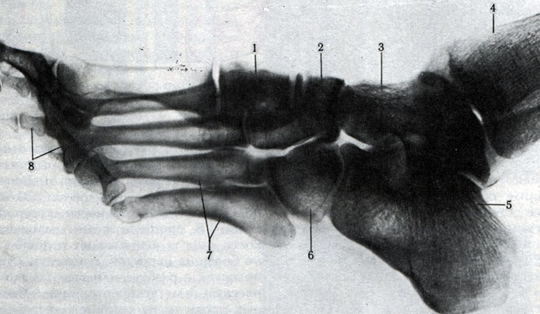 32 .  . 1 -   ; 2 -  ; 3 -  ; 4 -  ; 5 -  ; 6 -  ; 7 -  ; 8 - 