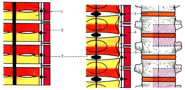 41.    ( Clar). 1 - ; 2 - ; 3 - discus intervertebralis; 4 - ; 5 - ,     