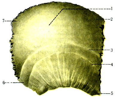 50.   ,  . 1 - tuber parietale; 2 - margo frontalis; 3 - linea temporalis superior; 4 - linea temporalis inferior; 5 - angulus sphenoidalis; 6 - angulus mastoideus; 7 - angulus occipitalis