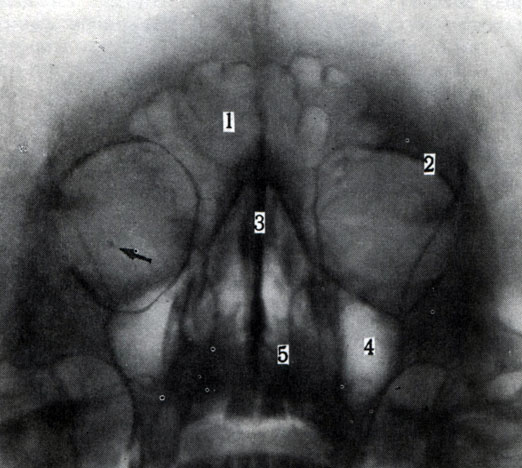 68.    ( . . ). 1 -   ; 2 -  ; 3 -   ; 4 -    ; 5 -   