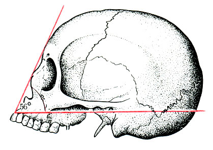 78.  ,     ( Broca)