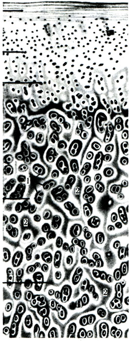 101 .    ( Goerttler). 1 -  ; 2 -    