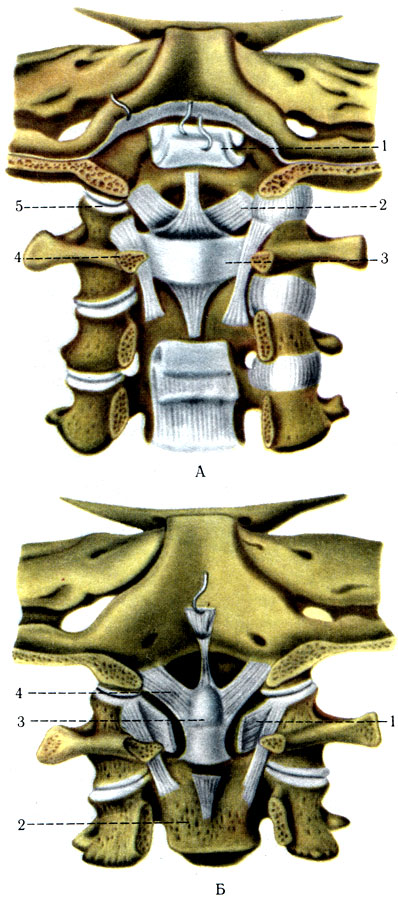 105.       ( ).   . : 1 - membrana tectoria; 2 - ligg. alaria; 3 - lig. transversum atlantis; 4 - atlas; 5 - articulatio atlantooccipitalis; : 1 - lig. transversum atlantis (); 2 - axis; 3 - dens axis; 4 - ligg. alaria