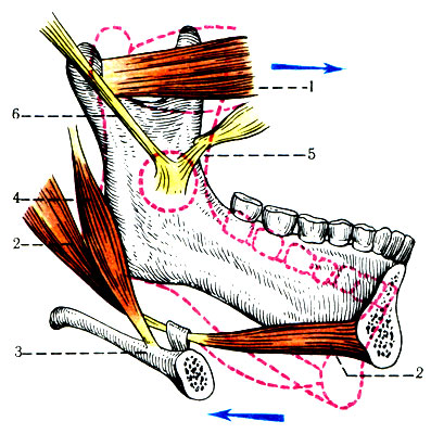 118.     ( . . ). 1 - m. pterygoideus lateralis; 2 - m. digastricus; 3 - os hyoideum; 4 - m. stylohyoideum; 5 - lig. sphenomandibulare; 6 - lig. stylomandibulare