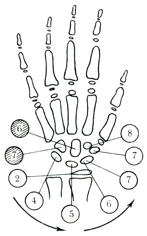 134.     ( Leonard).      ,   -   . 1 - os multangulum; 7 - os trapezoideum; 6, 7 - os naviculare; 5 - os lunatum; 4 - os triquetrum: 2 -     ; 7 - (II) - os hamatum; 6 - os capitatum