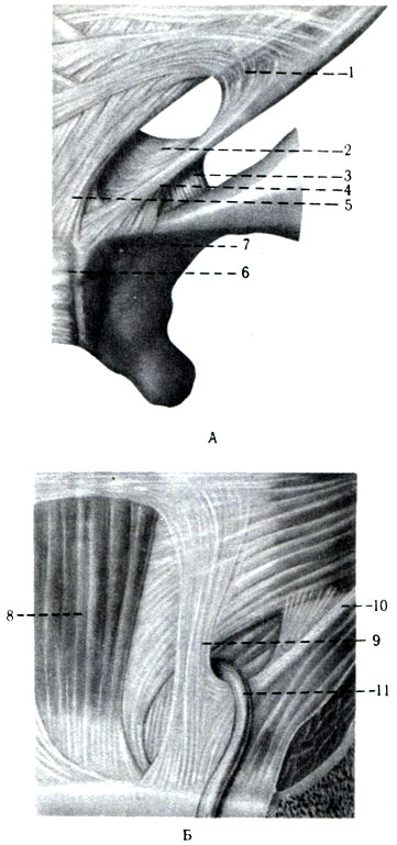 172.  ()   ()   (). 1 - fibrae intercrurales; 2 - lig. reflexum; 3 - lig. lacunare; 4 - crus mediate; 5 - crus laterale; 6 - symphysis ossis pubis; 7 - r. supe rior ossis pubis; 8 - m. rectus abdominis; 9 - lig. interfoveolare; 10 - lig. inguinale; 11 - ductus defferens