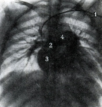 314.     .  (1)    .    (2),   (3),   (4)       ( . . )