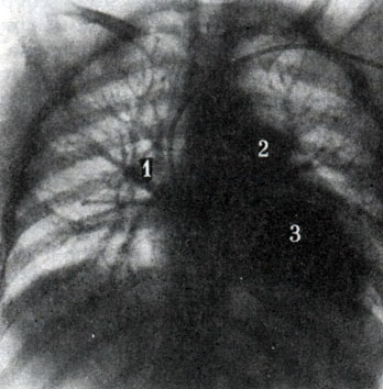 315.      ( . . ).     .    (1),   (2),   (3).     