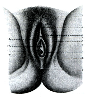 336.     ( Pay , ). 1 - mons pubis; 2 - commissura labiorum anterior; 3 - preputium clitoridis; 4 - glansclitoridis; 5 - labium majus; 6 - labium minus; 7 - ductus glandulae vestibularis majoris; 8 - commissura labiorum posterior; 9 - anus; 10 - hymen; 11 - ostium vaginae; 12 - ostium urethrae externum; 13 - frenulum clitoridis