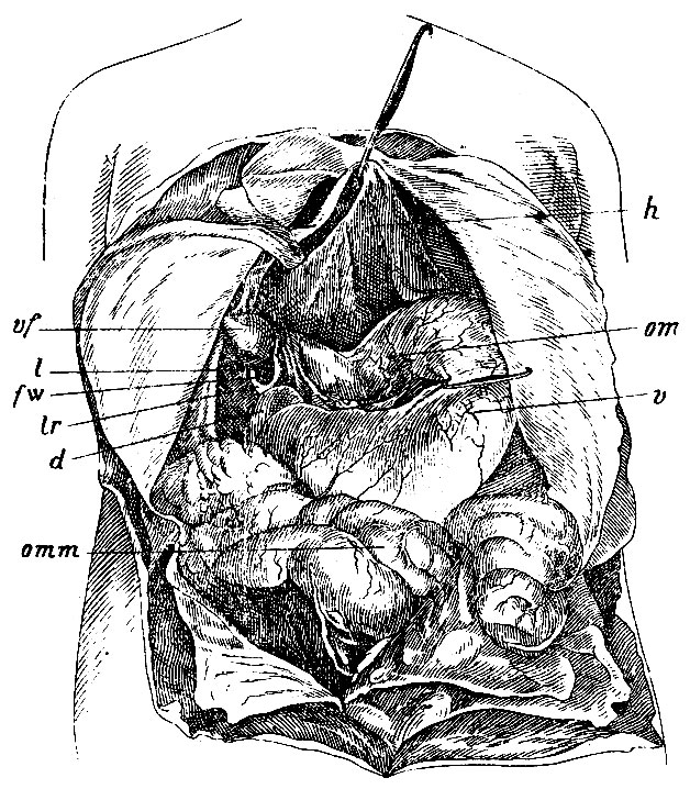 . 212.    bursae praegastricae et bursae hepaticae,    ,    bursa omentalis.     ;    ,    ,    ;  ,         ;       ;     (m) . v - ; h - ; vf -  ; fW - foramen Winslovii; I -lig- hepato-duodenale; lr - lig. hepato-renale; d - duodenum; omm-  ( )