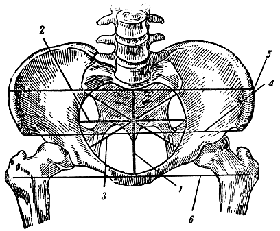 . 88.   . 1 -  , diameter recta (conjugata anatomica); 2 -  , diameter transversa (distantia transversa); 3 -  , diameter obliqua (distantia obliqua); 4 -  ; 5 -  ; 6 -  