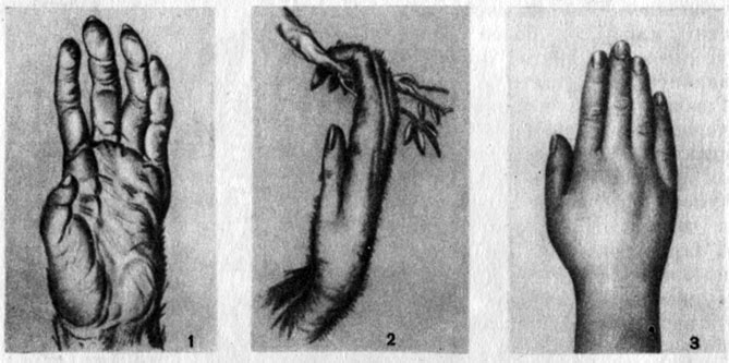 . 5.  : 1 - ; 2 - ; 3 - 