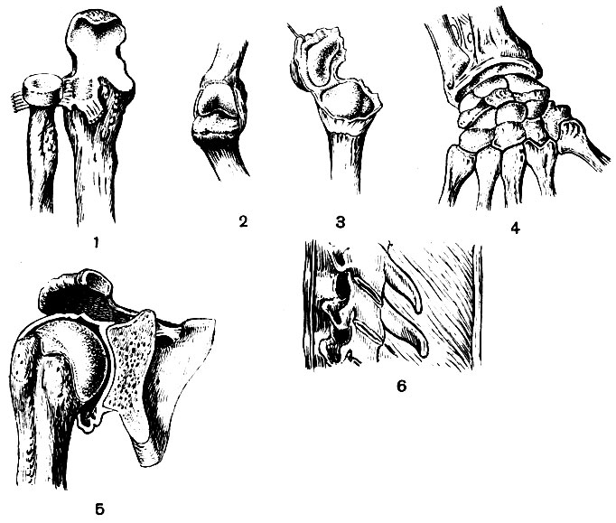 . 11.  : 1 -  ( ); 2 - . (); 3 -  (- I ); 4  (); 5 -  (); 6 -  (   )