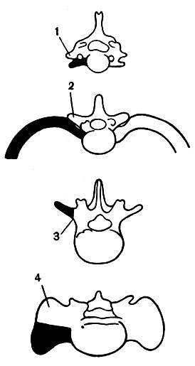. 12.       : 1 -   , 2 - , 3 -   4 -  ;     