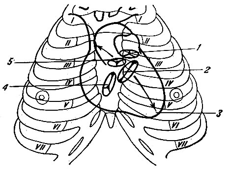 . 143.       ,    . 1 -   ; 2 -   - () ; 3 -  ; 4 -   - () ; 5 -    .      -   