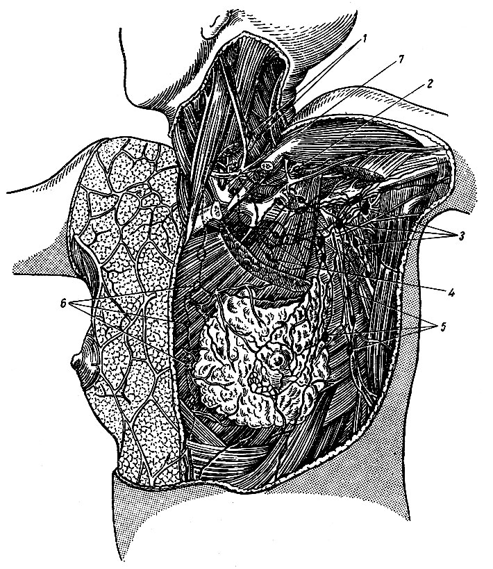 . 184.     . 1 - nodi lymphatici cervicales profundi inferiores; 2 - nodus lymphaticus infraclavicularis; 3 - nodi lymphatici axiliares; 4, 5 - nodi lymphatici pectorales; 6 - nodi lymphatici parasternals; 7 - ductus thoracicus