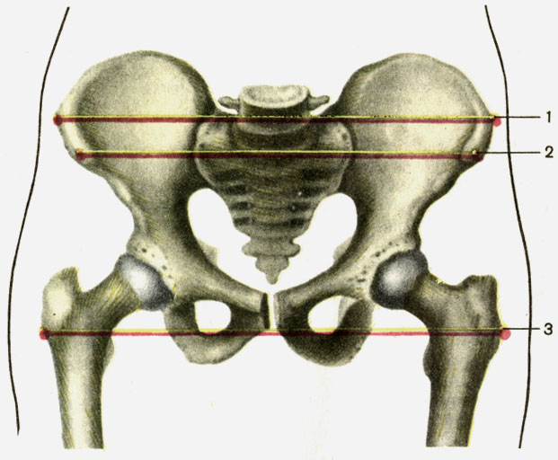 . 39.    . 1 -   (distantia cristarum); 2 -   (distantia spinarum); 3 -   (distantia trochanterica)