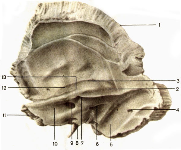 . 52.  ;  . 1 -   (pars squamosa); 2 -    (margo superior partis petrosae); 3 -    (tegmen tympani); 4 -   (foramen mastoideum); 5 -    (sulcus sinus sig- moidei); 6 -   (aqueductus vestibuli); 7 -   (fossa subarcuata); 8 -   (processus styloideus); 9 -    (porus acusticus internus); 10 -    (facies posterior partis petrosae); 11 -  ,   (pars petrosa); 12 -    (facies anterior partis petrosae); 13 -   (eminentia arcuata)