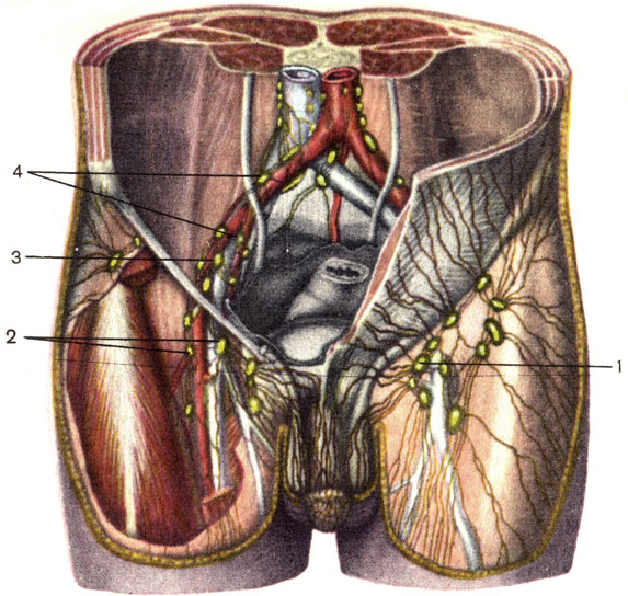 . 166.        . 1 -     (nodi lymphatici inguinales superficiales); 2 -     (nodi lymphatici inguinales profundi); 3 -     (nodi lymphatici iliaci externi); 4 -     (nodi lymphatici iliaci interni)