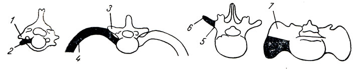 . 17.    ()          - , ,   . 1 - processus transversus; 2 - processus costarius ( ); 3 - processus transversus ( ); 4 - costa; 5 - processus transversus; 6 - processus costarius ( ); 7 - processus transversus ( )