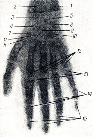 . 46.    6 . 1 -   ; 2 -   ; 3 -   ; 4 -    ; 5 - ; 6 - ; 7 - os trapezium. 8 -  I  ; 9 - ; 10 - ; 11 - os trapezoideum; 12 -  II-V  ; 13 -   ; 14 -   ; 15 -   