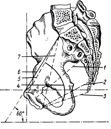 . 53.      ( ). 1 -       ; 2 -       ; 3 -      ; 4 -  ; 5 -  , conjugata gynecologica s. vera; 6 -  , conjugata anatomica; 7 -  . conjugata diagonalis; 60 -   