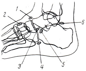 . 63.    ()   ( . . , . . -, . . ). 1 - os supranaviculare; 2 - os intercuneiforme; 3 - os calcaneum secundarium; 4 - os sesamoideum peioneum; 5 - os tibiale externun; 6 - os trigonum