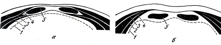 . 72.        .  -  ;  -  ; 1 -   ; 2 -   ; 3 -    ; 4 -    ; 5 -   