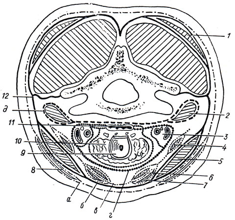 . 80.      (,  . . ). 1 - m. trapezius; 2 - m. scalenus ant. 3 - - ; 4 - m. omohyoideus; 5 - m. sternocleidomastoideus; 6 - m. thyreohyoideus; 7 - m. sternothyreoideus; 8 - m. platysma; 9 - ; 10 -  ; 11 - ; 12 -  ,      ;  - I ;  - II ;  - III ;  - IV ;  - V 
