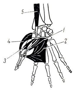 . 91.     . 1 - m. flexor pollicis brevis; 2 - m. adductor pollicis; 3 - m. opponens; 4 - m. abductor pollicis brevis; 5 - m. flexor pollicis longus