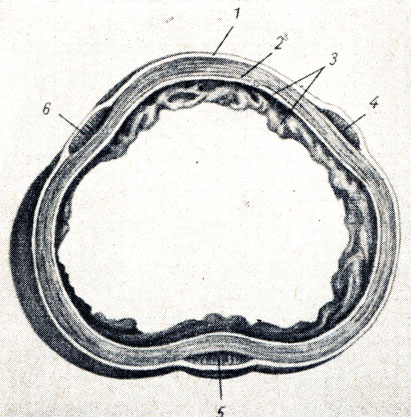 . 140.     (  - ). 1 - tunica serosa; 2 - tunica muscularis; 3 - tunica mucosa; 4, 5, 6 -        ; 4 - tenia omentalis; 5 - tenia mesocolica; 6 - tenia libera