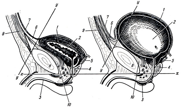 . 170.            . 1 - tunica muscularis vesicae urinariae; 2 - cavum; 3 - urethra; 4 - prostata; 5 - ductus deferens; 6 - lig. umbilicale medianum; 7 - peritoneum; 8 -  symphysis pubica; 9 -   ; 10 -  ;  -  -  ,     symphysis pubica;  -  -   
