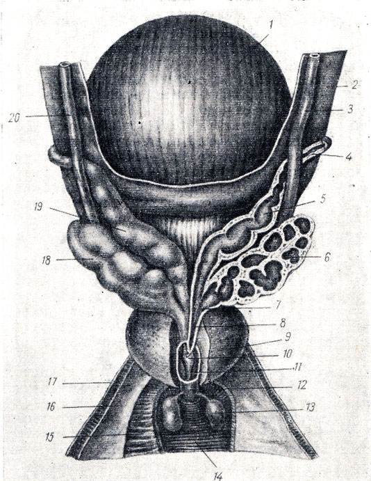 . 172.     . 1 - vesica urinaria; 2 - peritoneum; 3, 20 - ureter (dext. et sin.); 4 - ductus deferens; 5, 19 - ampulla ductus deferentis (dext. et sin.); 6, 18 - vesicula seminalis (dext. et sin.); 7 - ductus excretonus; 8 - ductus ejaculatorius; 9 - lobus dext. prostatae; 10 - tunica mucosa urethrae; 11 - pars prostatica urethrae; 12 - pars membranacea urethrae; 13 - glandula bulbourethral (Cowperi); 14, 15 - m transfersus perinei profundus; 16 - fascia diaphragmatis urogenital superior; 17 - fascia diafragmatis urogenitalis inferior