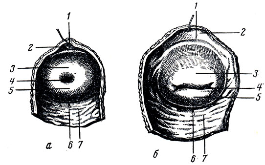 . 180.   (portio vaginalis)   ( ).  -  ;  -  . 1 - fornix vaginae (anterior); 2 - paries anterior vaginae; 3 - labium anterius; 4 - ostium uteri; 5 - labium posterius; 6 - fornix vaginae (posterior); 7 - paries posterior vaginae