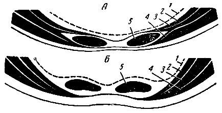 . 139.        .  -    3/4   ;  -    1/4   ; 1 -  () ; 2 -   ; 3 -    ; 4 -    ; 5 -   