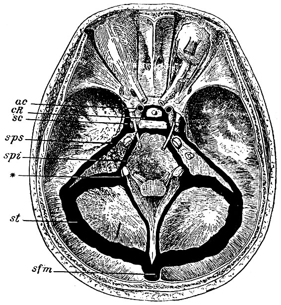 . 50.        .   . sc - sinus cavernosus; cR - circulus venosus Ridleyi; sps - sinus petrosus superior; spi - sinus petrosus inferior; st - sinus transversus; sfm -     (sinus falciformis major); * -   ,     for. jugulare; ac - a. carotis interna     