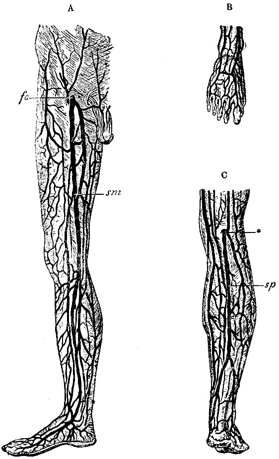 . 61.  -    : sm - v. saphena magna; fo - fossa ovalis fasciae latae,  v. saphena    .  -     .  -     : sp - v. saphena parva; * -  fasciae popliteae,   s. saphena parva  ,     
