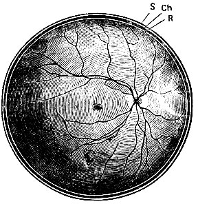 . 152.     .      ;    - papilla n. optici   -. R - ; Ch -  ; S - sclera