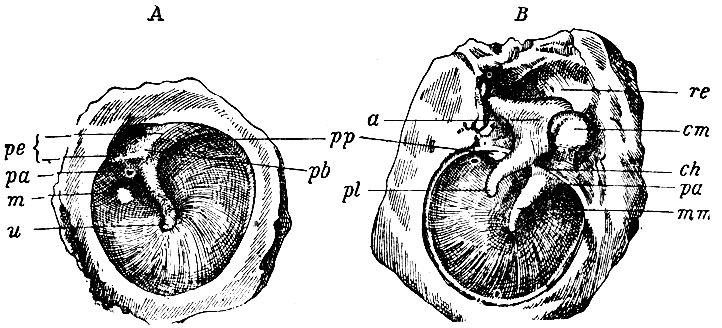 . 176. A -    (    ). B -    ,      . A: u -   ; m - stria malleolaris; pb - prominentia malleolaris; pe -      ; pa, pp -       ,     . B: re -  recessus epitympanici; cm -  ; mm -  ; a -  ; pl -   ; pp -    ; pa -    ; ch - chorda tympani