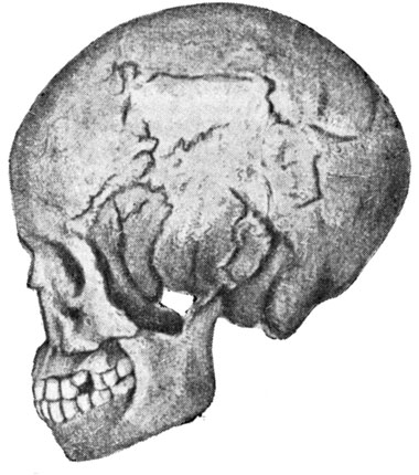 . 47.     (  )      (1906)