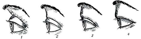 . 86.       : 1 -  , 2 -  , 3 -  , 4 -  
