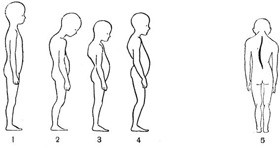 . 20.  : 1 - ; 2 - ; 3 - ; 2 - ; 5 - 