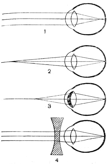 . 49.    : 1 -   (    ); 2 -      ( ); 3 -     (  ); 4 -      