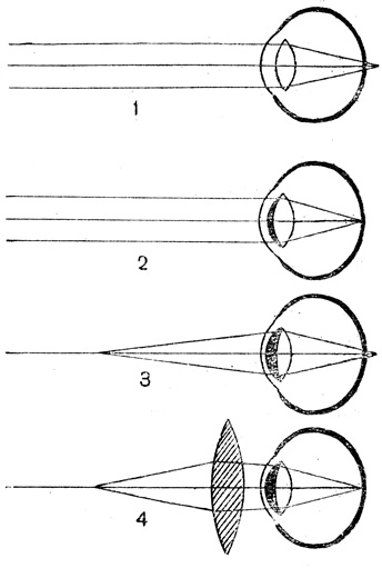 . 50.    : 1 -   (    ); 2 -     ; 3 -      ,   25   ,   ; 4 -      