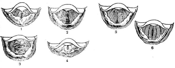 . 77.   ( ): 1 -   ; 2 -  ; 3 -    (       ); 4 -           ; 5 -  ; 6 -   