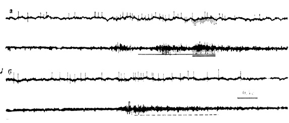 . 49.      ,  - 140-    ( 11  1 )     .         ,                -    ; 5 -        150- .      -  ,   -     (. . , . . , 1967)